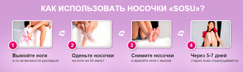 Как пользоваться носочками для ног. Педикюрные носочки sosu. Силиконовые носки для педикюра. Sosu маска для ног. Кислотные носочки для педикюра.